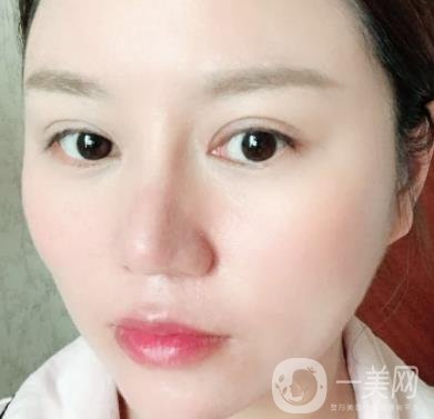 張掖市人民醫(yī)院美容整形科價(jià)格表，附眼袋切除*果圖