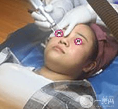 岳陽(yáng)市第一人民醫(yī)院整形美容科祛斑好嗎？?jī)r(jià)格表和案例日記分享