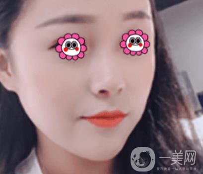 岳陽(yáng)市第一人民醫(yī)院整形美容科祛斑好嗎？?jī)r(jià)格表和案例日記分享