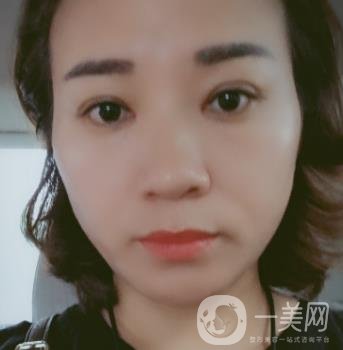 中山一院整形科價格表,及切腋臭日記一覽