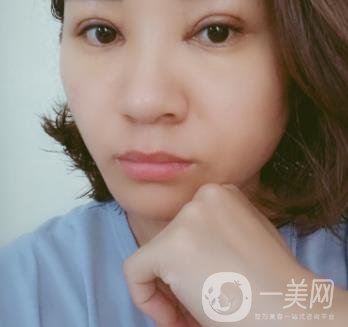 中山一院整形科價格表,及切腋臭日記一覽