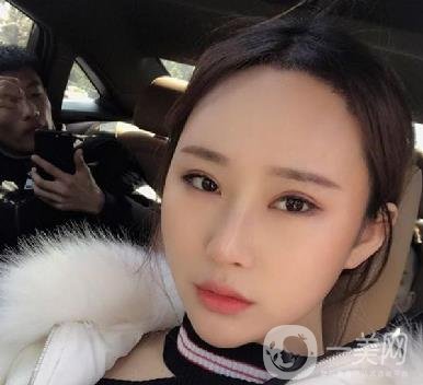 河北省中醫(yī)院整形美容科隆鼻怎么樣？?jī)r(jià)格表及術(shù)后恢復(fù)日記分享