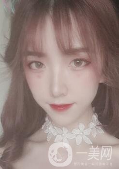 南昌二附院整形科價格表2020，附肋軟骨隆鼻整形案例