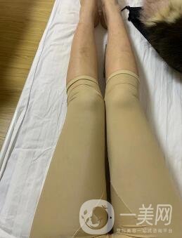 福建省立醫(yī)院整形科價(jià)格(目)表2020，附大小腿吸脂案例