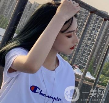 北京醫(yī)院趙紅藝做鼻子多少錢?價格表和真人*果變化圖一覽