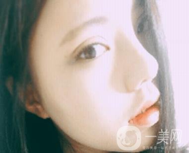 西安唐都醫(yī)院價格表價目表，內(nèi)附吳瓊隆鼻整形日記