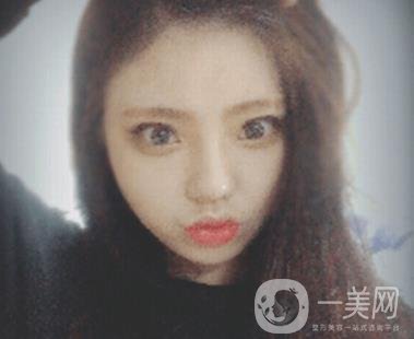 西安唐都醫(yī)院價格表價目表，內(nèi)附吳瓊隆鼻整形日記