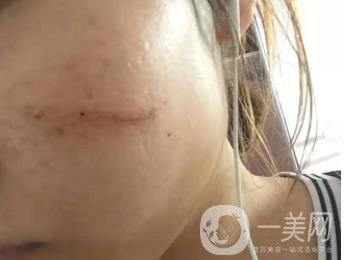 西安市中心醫(yī)院整形科價(jià)目價(jià)格一覽，附陶諫祛疤案例*果圖