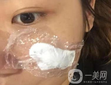 西安市中心醫(yī)院整形科價(jià)目價(jià)格一覽，附陶諫祛疤案例*果圖