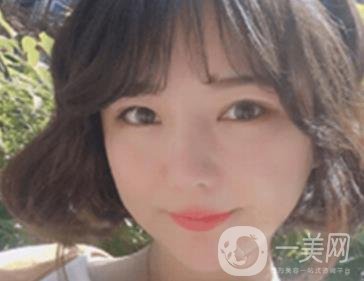 廣州博仕整形醫(yī)院做鼻子多少錢?價格表和整形恢復(fù)日記一覽