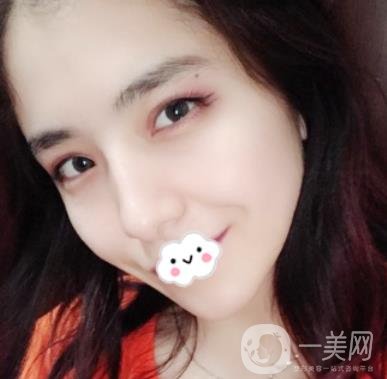 上海伯思立整形怎么樣？附沈國(guó)雄隆鼻案例及整形價(jià)格表