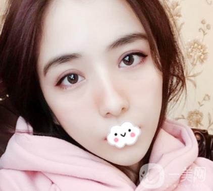 上海伯思立整形怎么樣？附沈國(guó)雄隆鼻案例及整形價(jià)格表