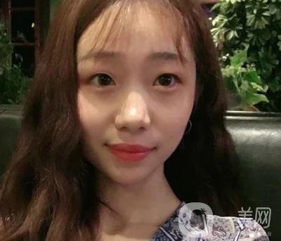 上海華美李志海磨骨多少錢？案例有嗎？整形價(jià)格表一覽