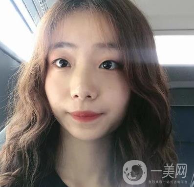 上海華美李志海磨骨多少錢？案例有嗎？整形價(jià)格表一覽
