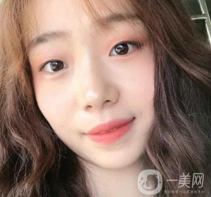 上海華美李志海磨骨多少錢？案例有嗎？整形價(jià)格表一覽