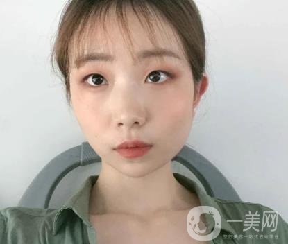 上海華美李志海磨骨多少錢？案例有嗎？整形價(jià)格表一覽