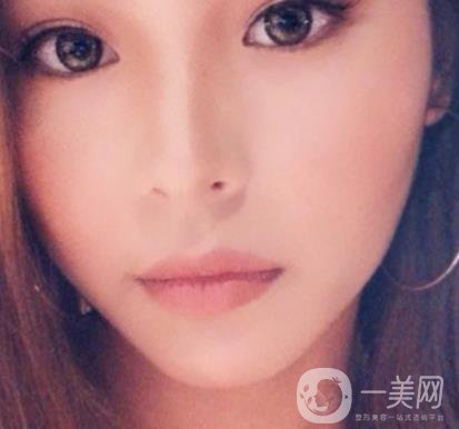 上海九院切下頜角手術(shù)經(jīng)歷分享，附2020整形價(jià)格一覽表