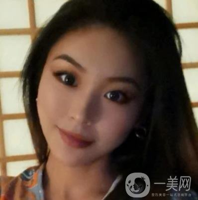 上海九院切下頜角手術(shù)經(jīng)歷分享，附2020整形價(jià)格一覽表