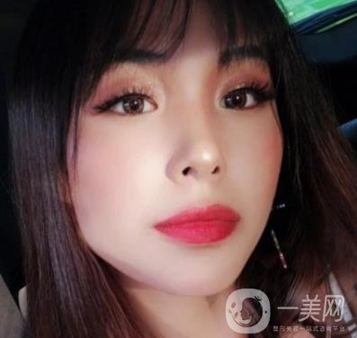 上海九院切下頜角手術(shù)經(jīng)歷分享，附2020整形價(jià)格一覽表