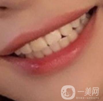 長征醫(yī)院 整牙