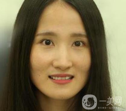 北京市海淀醫(yī)院整牙多少錢？看價格表及案例*果