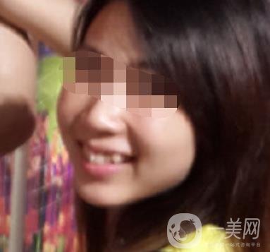 南昌大學(xué)第二附屬醫(yī)院整牙60天案例，還有價(jià)格表哦