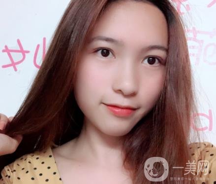 沈陽軍區(qū)總醫(yī)院整形外科價(jià)格表2020，附雙眼皮案例