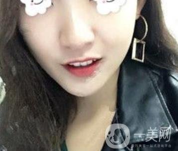 浙二醫(yī)院整形美容科價(jià)格表*新版，附激光祛斑*終*果圖