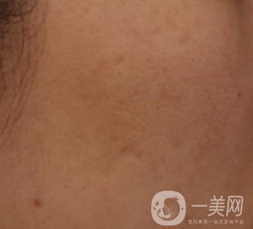 南通維多利亞美容醫(yī)院怎么樣?價格表收費項目和祛痘*果實拍圖