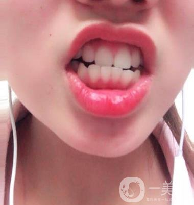 301醫(yī)院整牙