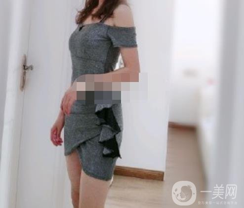 安陽(yáng)地區(qū)醫(yī)院抽脂