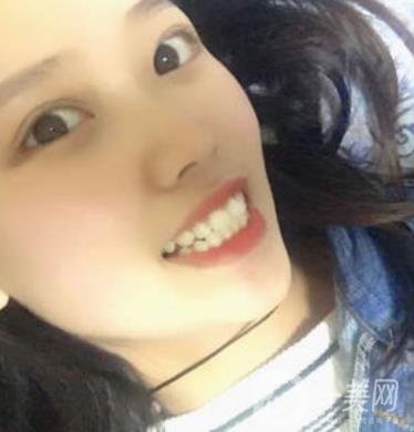 北大第三醫(yī)院整牙