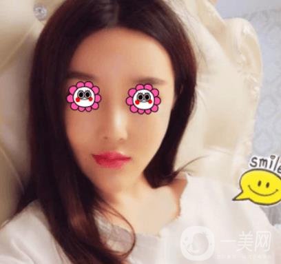 長(zhǎng)沙中南大學(xué)*三醫(yī)院整形美容外科隆鼻多少錢？?jī)r(jià)格表及案例詳情