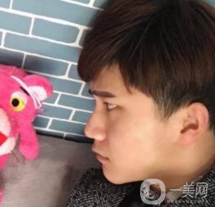 棗莊市立醫(yī)院燒傷整形美容科做光子嫩膚好嗎？價格表及術(shù)后*果分享