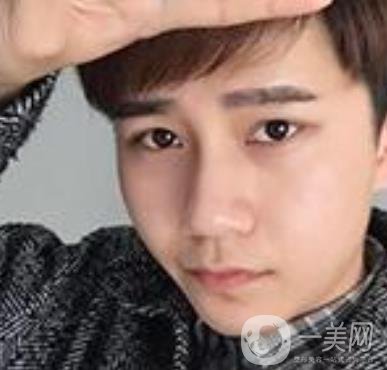 棗莊市立醫(yī)院燒傷整形美容科做光子嫩膚好嗎？價格表及術(shù)后*果分享