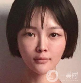 石家莊市醫(yī)院整形美容外科價(jià)格表2020，附雙眼皮實(shí)例