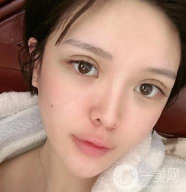 石家莊市醫(yī)院整形美容外科價(jià)格表2020，附雙眼皮實(shí)例