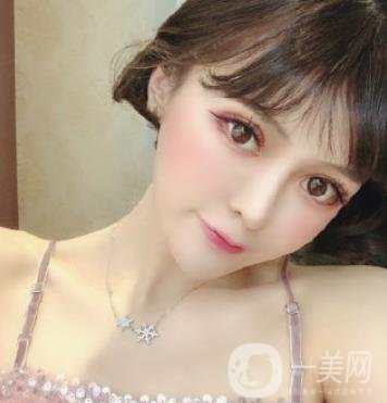 石家莊市醫(yī)院整形美容外科價(jià)格表2020，附雙眼皮實(shí)例