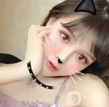 石家莊市醫(yī)院整形美容外科價(jià)格表2020，附雙眼皮實(shí)例