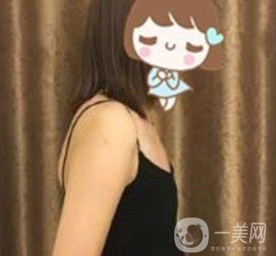 上海李斌醫(yī)療美容隆胸怎么樣?項(xiàng)目整形價(jià)格表收費(fèi)標(biāo)準(zhǔn)公布