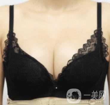 上海美貝爾明橋醫(yī)院價(jià)格(目)一覽表，附孫超醫(yī)生隆胸經(jīng)驗(yàn)分享