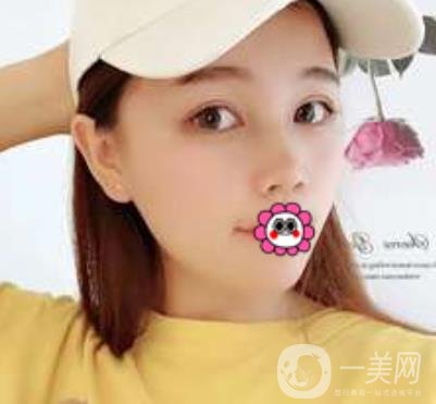 河南省人民醫(yī)院誰(shuí)做雙眼皮好？附案例及2020整形價(jià)格表