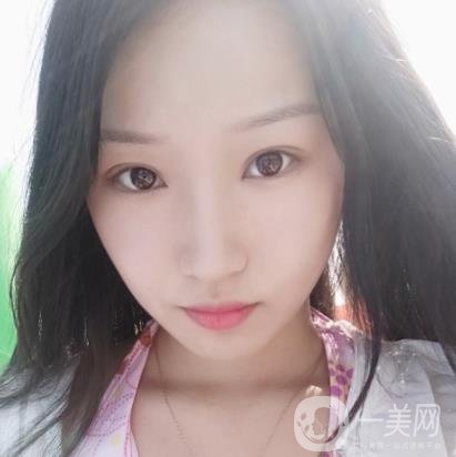 北大醫(yī)院美容價(jià)格表，附自體脂肪填充面部前后照