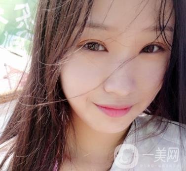 北大醫(yī)院美容價(jià)格表，附自體脂肪填充面部前后照