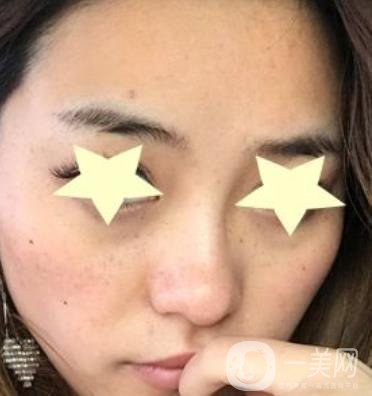 珠海中西醫(yī)結(jié)合醫(yī)院整形價格表及激光祛斑案例一覽