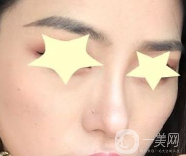 珠海中西醫(yī)結(jié)合醫(yī)院整形價格表及激光祛斑案例一覽