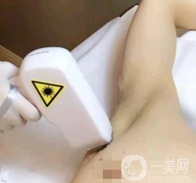 廈門中醫(yī)院陳華脫毛靠譜嗎？價(jià)格表及案例*果一覽