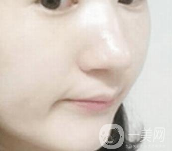 南通大學(xué)附屬醫(yī)院整形科價(jià)格表，附激光去疤案例