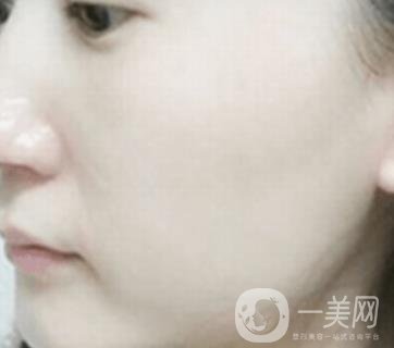 南通大學(xué)附屬醫(yī)院整形科價(jià)格表，附激光去疤案例