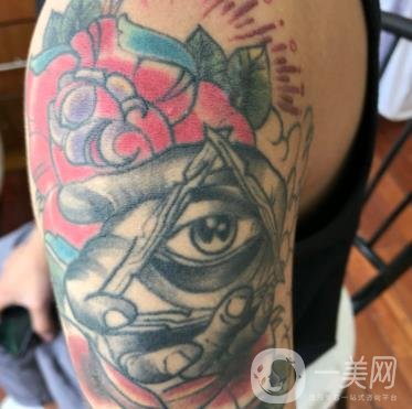 徐州市中心醫(yī)院整形科價格表，附洗紋身案例